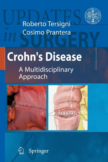 Crohn’s Disease