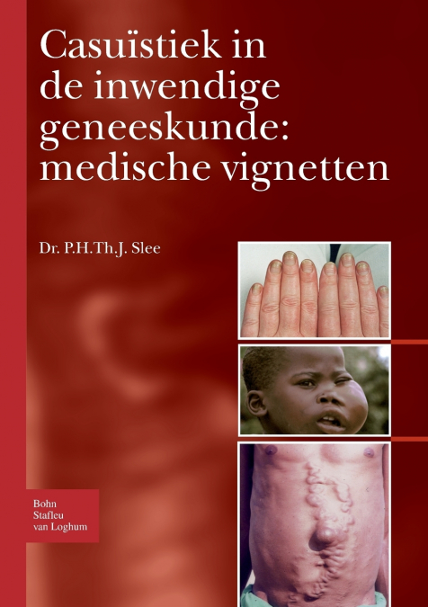 Casuïstiek in de inwendige geneeskunde