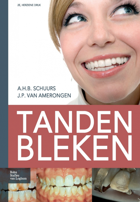 Tanden bleken