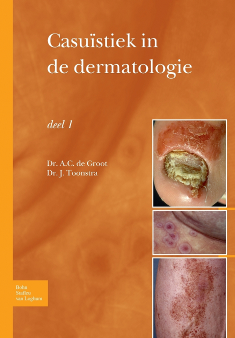 Casuïstiek in de dermatologie deel I