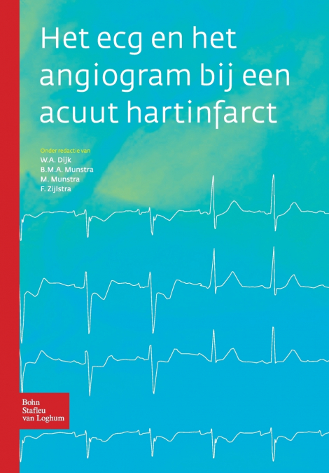 Het ecg en het angiogram bij een acuut hartinfarct