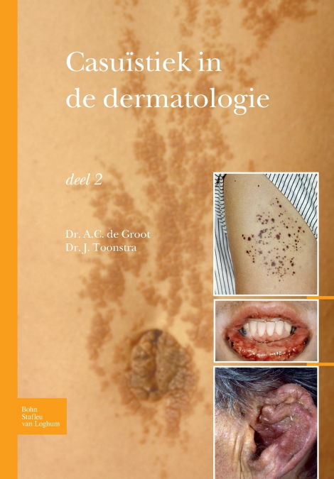 Casuïstiek in de dermatologie