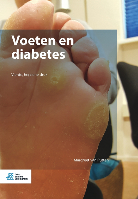 Voeten en diabetes