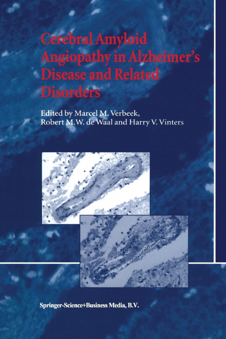 Cerebral Amyloid Angiopathy in Alzheimer’s Disease and Related Disorders