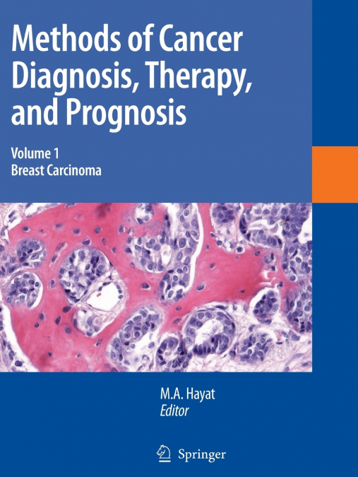 Methods of Cancer Diagnosis, Therapy and Prognosis