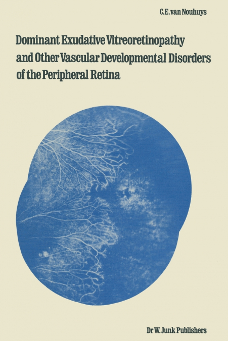 Dominant Exudative Vitreoretinopathy and Other Vascular Developmental Disorders of the Peripheral Retina