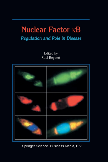 Nuclear Factor кB