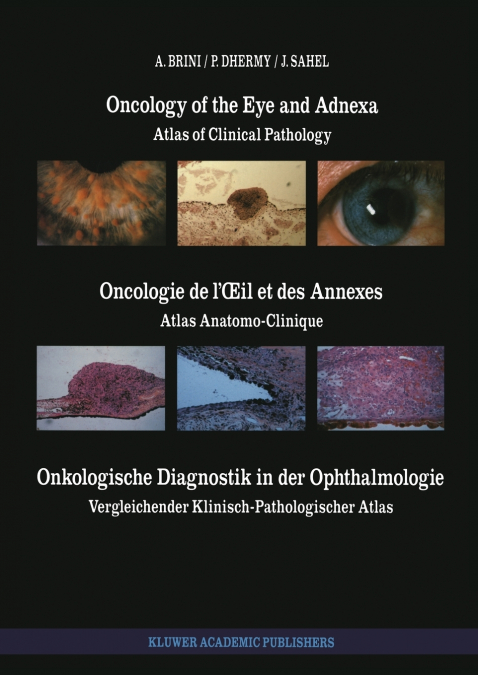 Oncology of the Eye and Adnexa / Oncologie de l’Œil et des Annexes / Onkologische Diagnostik in der Ophthalmologie