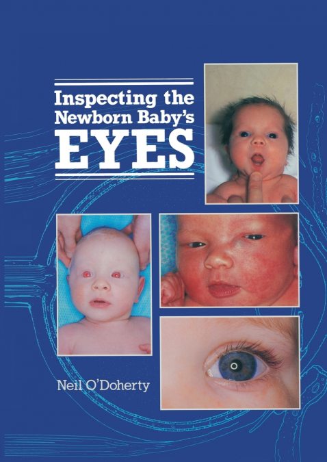 Inspecting the Newborn Baby’s Eyes