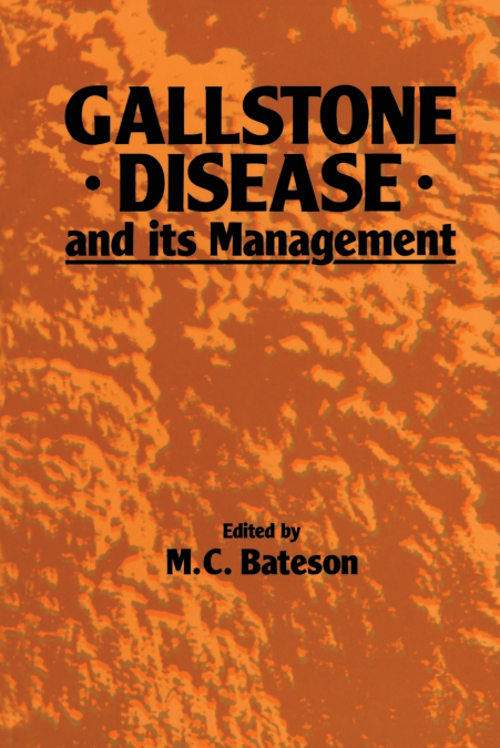 Gallstone Disease and Its Management