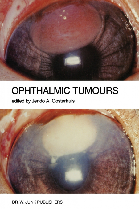 Ophthalmic Tumours