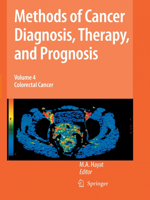 Methods of Cancer Diagnosis, Therapy and Prognosis