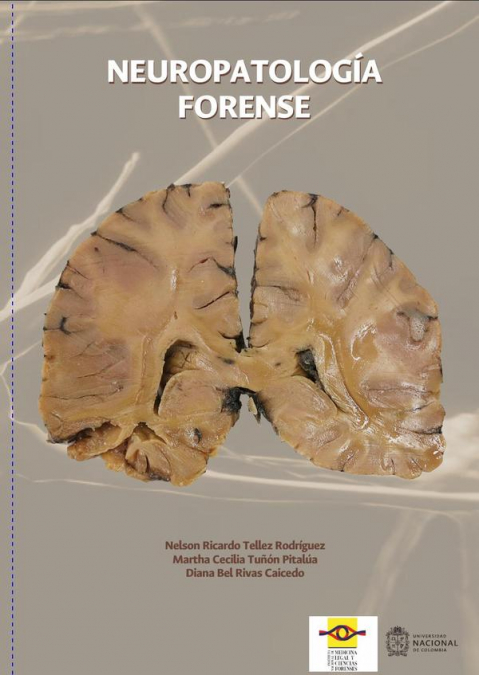 Neuropatología forense