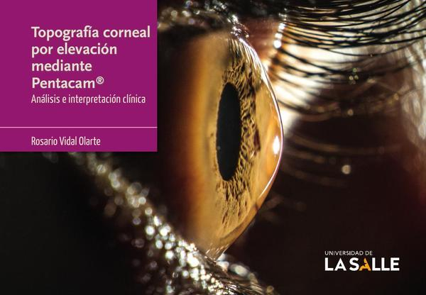 Topografía corneal por elevación mediante Pentacam®