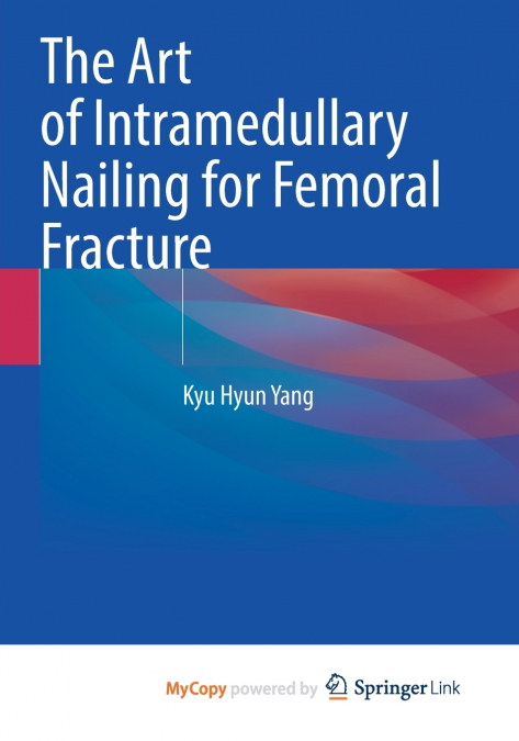The Art of Intramedullary Nailing for Femoral Fracture