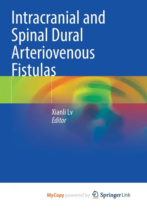 Intracranial and Spinal Dural Arteriovenous Fistulas