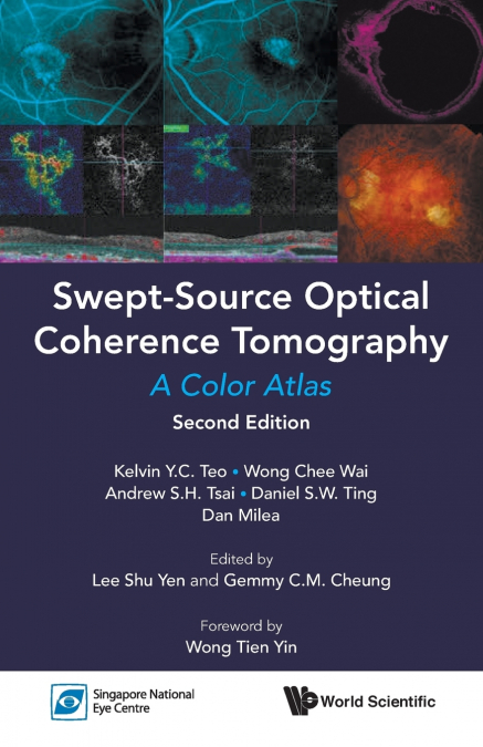 SWEPT-SOURCE OPTIC COHE (2ND ED)