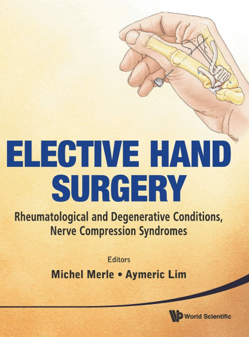 Elective Hand Surgery