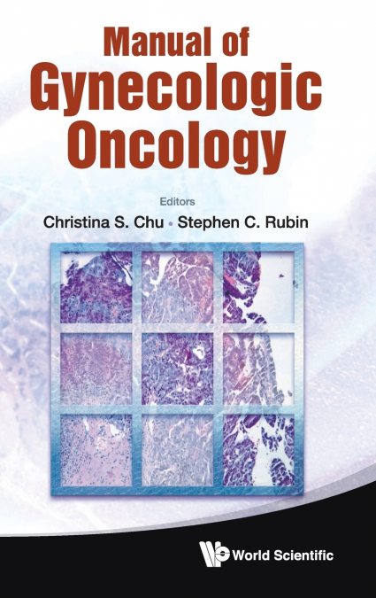 MANUAL OF GYNECOLOGIC ONCOLOGY