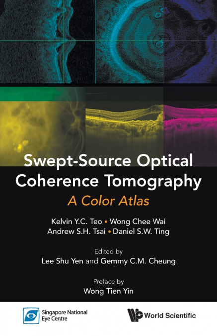 SWEPT-SOURCE OPTICAL COHERENCE TOMOGRAPHY