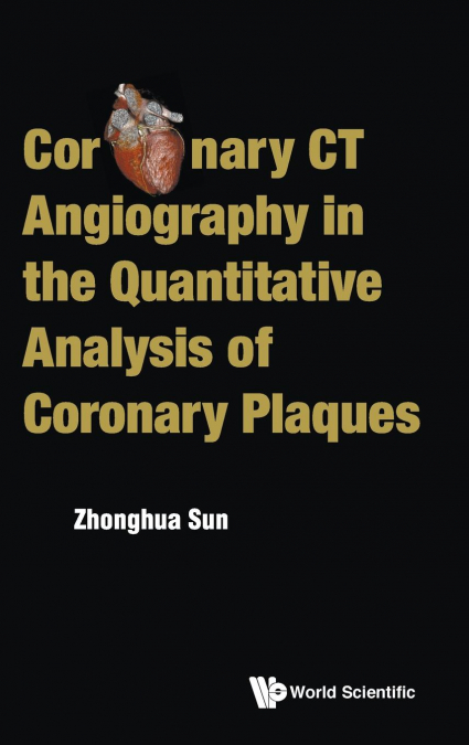 CORONARY CT ANGIOGRAPHY QUANTITATIVE ANALYSIS CORONARY PLAQU