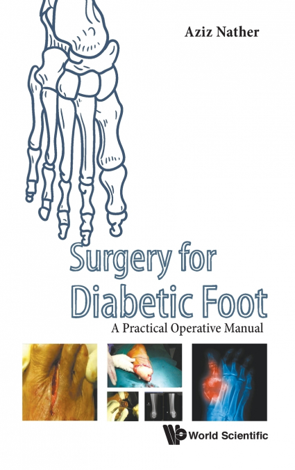 SURGERY FOR DIABETIC FOOT