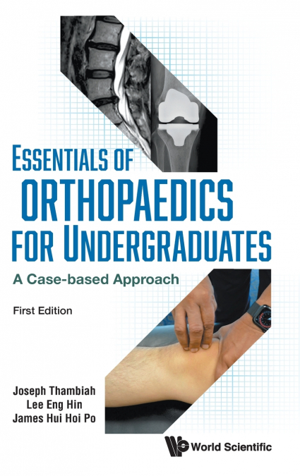 ESSENTIALS OF ORHTOPAEDICS FOR UNDERGRADUATES