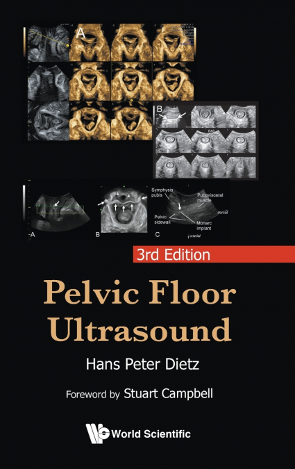 PELVIC FLOOR ULTRASOUND (3RD ED)