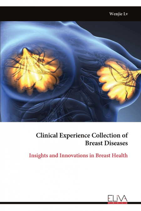 Clinical Experience Collection of Breast Diseases