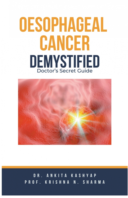 Oesophageal Cancer Demystified Doctors Secret Guide