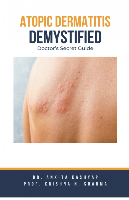 Atopic Dermatitis Demystified