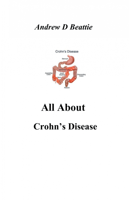 All About Crohn’s Disease