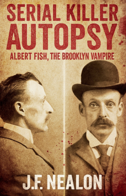 Serial Killer Autopsy