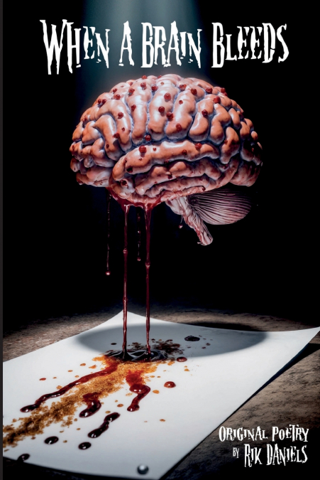 When a Brain Bleeds