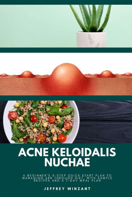 Acne Keloidalis Nuchae