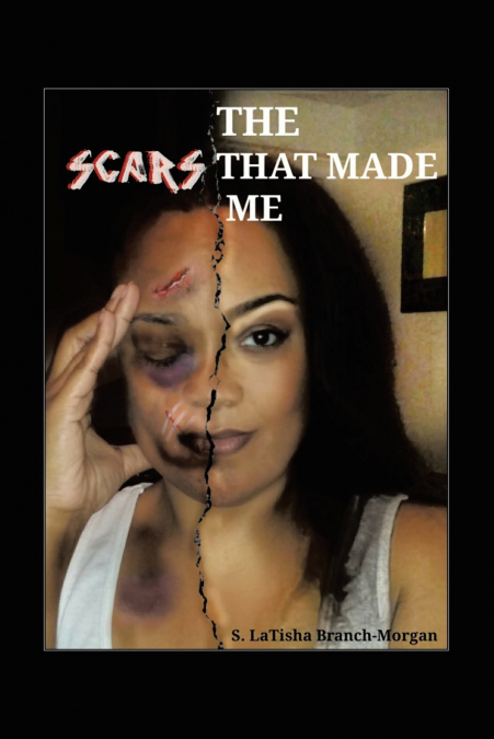 THE SCARS THAT MADE ME