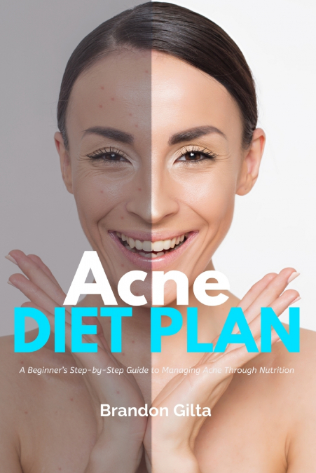 Acne Diet Plan