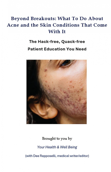 Beyond Breakouts